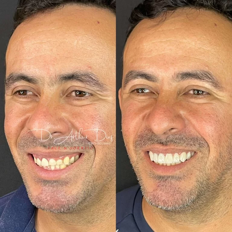 4708B23E-75E5-4DF3-A2A6-DAD63DC8266F-768x768